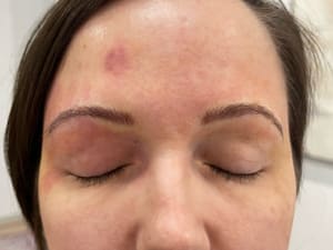 Eyebrow Tattoo result by Esthetic Artistry Brow Studio in Fulshear, TX
