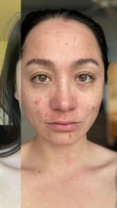 Eyebrow Tattoo result by Everglow Esthetics LLC in Longmont, CO