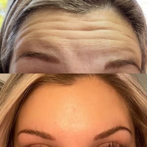 Eyebrow Tattoo result by Everlasting Aesthetics in Longview, TX