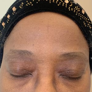 Eyebrow Tattoo result by Eyebrow Paradise~Microblading & Permanent Make up. in Sunny Isles Beach, FL