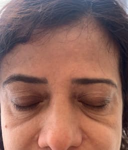 Eyebrow Tattoo result by Eyebrow Paradise~Microblading & Permanent Make up. in Sunny Isles Beach, FL