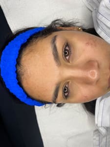 Eyebrow Tattoo result by EYEBROWS - LASHES Marce Botero in Pembroke Pines, FL