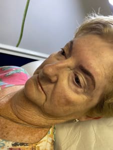 Eyebrow Tattoo result by EyeCandy in Vero Beach, FL