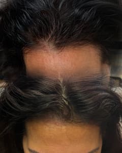 Eyebrow Tattoo result by Eyedolized Brows in Little Falls Township, NJ