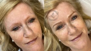 Eyebrow Tattoo result by EyelashYou LLC in Madison, AL