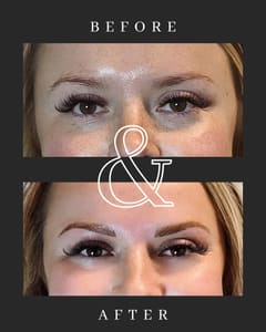 Eyebrow Tattoo result by Facade Beauty in Ca On City, CO