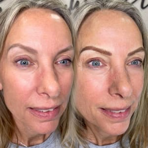 Eyebrow Tattoo result by Face First Esthetics in Boca Raton, FL