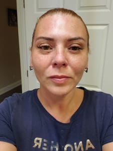 Eyebrow Tattoo result by Facesthetix Boca Raton in Boca Raton, FL
