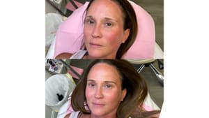 Eyebrow Tattoo result by Facial Esthetics by Rosa in Granger, IN
