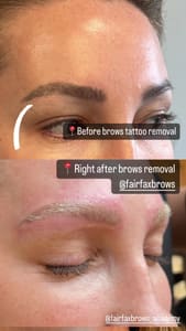 Eyebrow Tattoo result by FAIRFAX BROWS LLC in Fairfax, VA