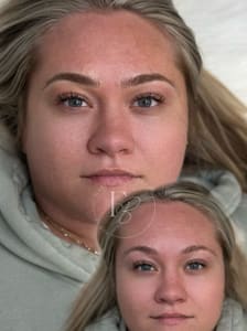 Eyebrow Tattoo result by Fauxever Beauty in Elmhurst, IL