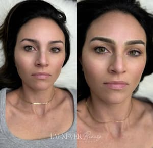 Eyebrow Tattoo result by Fauxever Beauty in Elmhurst, IL