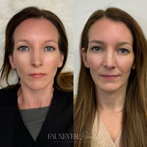 Eyebrow Tattoo result by Fauxever Beauty in Elmhurst, IL