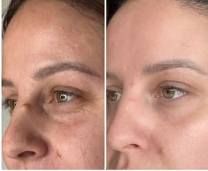 Eyebrow Tattoo result by Fibroplasmabeauty in Playa Del Rey, CA
