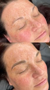Eyebrow Tattoo result by Fletcher Aesthetics in Franklin, TN