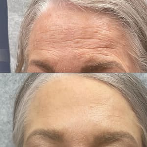 Eyebrow Tattoo result by Frankenmuth Aesthetics in Frankenmuth, MI