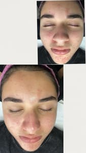 Eyebrow Tattoo result by Glow goddess spa in Redmond, WA