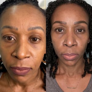Eyebrow Tattoo result by Grand Luxe Studio Paramedical Tattooing Semi Permanent Makeup in Laurelton, NY