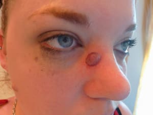 Eyebrow Tattoo result by Hair Free Skin - Dallas Electrolysis & School in Dallas, TX