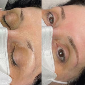 Eyebrow Tattoo result by Happy Brows Miami in Miami, FL