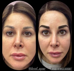 Eyebrow Tattoo result by Haus of Brows in Hollywood, FL