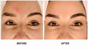 Eyebrow Tattoo result by Hella Yoffi Esthetics in Melbourne, FL