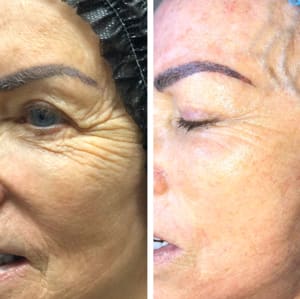 Eyebrow Tattoo result by HFskin Beauty Bar LLC in Mesa, AZ