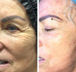 Eyebrow Tattoo result by HFskin Beauty Bar LLC in Mesa, AZ