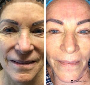 Eyebrow Tattoo result by HFskin Beauty Bar LLC in Mesa, AZ