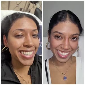 Eyebrow Tattoo result by Houston MedSpa + Wellness in Houston, TX