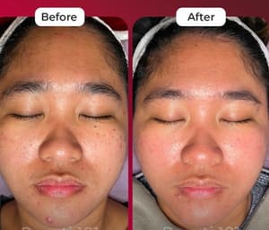 Eyebrow Tattoo result by I Beauty&Lash&Microblading in Chino Hills, CA