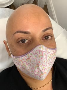 Eyebrow Tattoo result by I BrowYou - Microblading & Laser hair removal in Brooklyn, NY