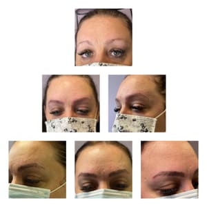 Eyebrow Tattoo result by iBeauty Clinic in Chicago, IL