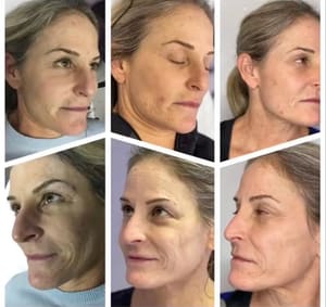 Eyebrow Tattoo result by iBeauty Clinic in Chicago, IL