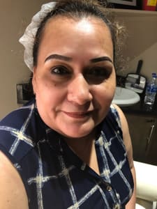 Eyebrow Tattoo result by iBrows By Sami in Austin, TX