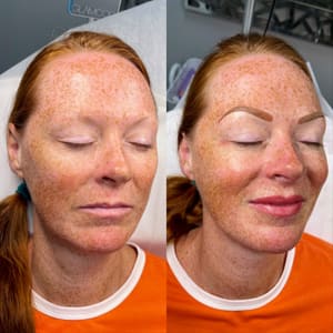 Eyebrow Tattoo result by In Bloom Beauty in Fort Myers, FL