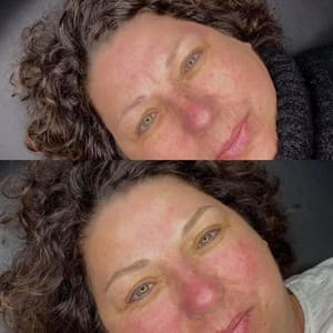 Eyebrow Tattoo result by Infinite Brows in Sioux Falls, SD