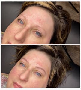 Eyebrow Tattoo result by Infinite Brows in Sioux Falls, SD