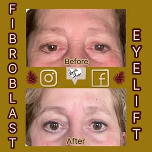 Eyebrow Tattoo result by Inkcredible Beauty 2 in Matawan, NJ
