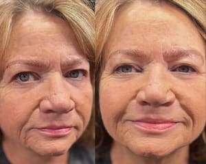 Eyebrow Tattoo result by Inked Esthetics Of West Atlanta in Villa Rica, GA