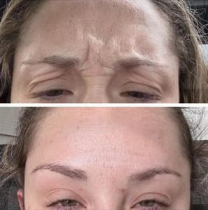 Eyebrow Tattoo result by Julia's Aesthetics in Loveland, CO