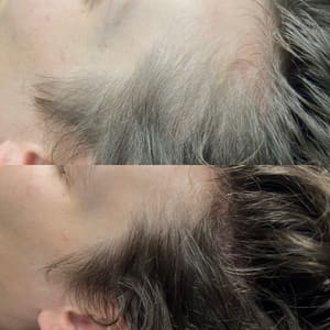 Eyebrow Tattoo result by K&K in Sherman Oaks, CA