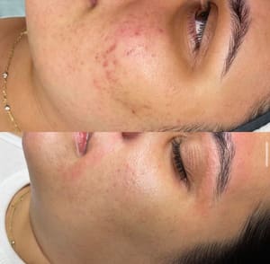 Eyebrow Tattoo result by K&K in Sherman Oaks, CA