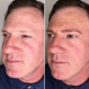 Eyebrow Tattoo result by Kate Brows Inc in Paradise Valley, AZ