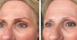 Eyebrow Tattoo result by Kathy Briggs Skin Care & Brow Artistry in Napa, CA
