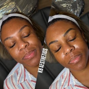 Eyebrow Tattoo result by KB Aesthetics in Shenandoah, TX