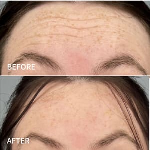 Eyebrow Tattoo result by Keyla Sanchez Aesthetics in Mckinney, TX