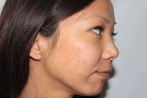 Eyebrow Tattoo result by Kim Van Aesthetics, INC in Garden Grove, CA