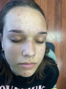 Eyebrow Tattoo result by KS Brows in Hercules, CA