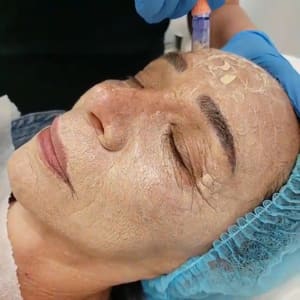 Eyebrow Tattoo result by KS Master Brow & Lash in Fountain Valley, CA